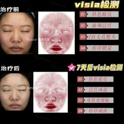 -Yestar重庆艺星医疗美容医院