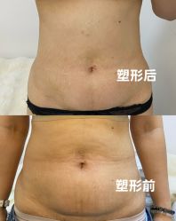 -Fundi张玉珊修身堂·indiba·BTL科技瘦身