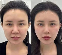 点击看大图 -Yestar艺星医疗美容医院