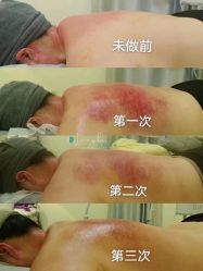 -良咔瘦身·减脂塑形