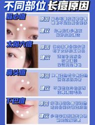 -苗方清颜痘肌研究所