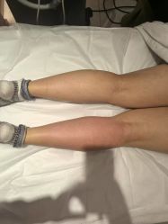 -Lily纤美·科技减脂中心