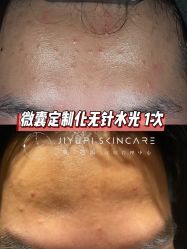 点击看大图 -MLP美丽派·问题肌疗愈中心