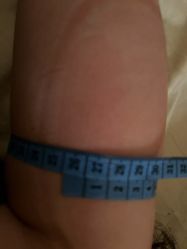 -肥三针腧穴瘦身馆