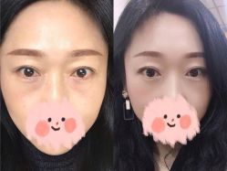 体验前-西美医疗美容门诊部