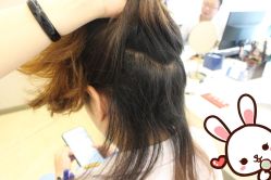 点击看大图 -大麦微针植发丨全国连锁