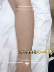 -植蔻妍倍儿专业脱毛·皮肤管理