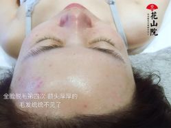 -觅屿日式脱毛美肤
