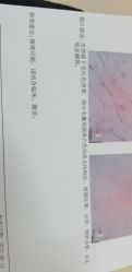 -成都苗方清颜专业祛痘