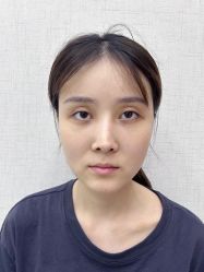 点击看大图 体验前-深圳艺星医疗美容医院