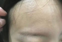 -郡艺医疗美容·微整·眼鼻吸脂