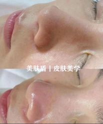 -美肤盾祛痘·问题肌头疗管理中心