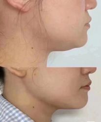-LUNA皮相美·骨相美高级美感