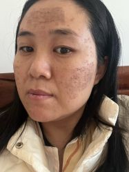 -空军总医院激光整形美容中心