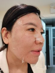 -海涛医疗美容·面部抗衰·注射美鼻