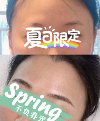 -Doris多里斯半永久纹眉·SMP纹发·发际线