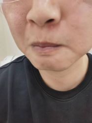 -痘院长·祛痘修护·皮肤管理
