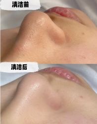 -尊尚柏丽美容SPA