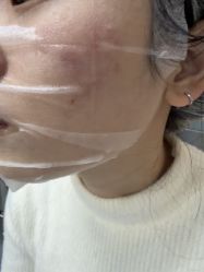 -长沙雅美医疗美容医院