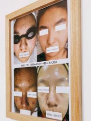 -美肤盾祛痘·问题肌头疗管理中心