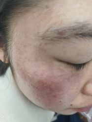 -长沙雅美医疗美容医院