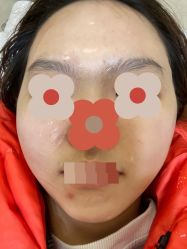 体验后-圣嘉新医疗美容医院