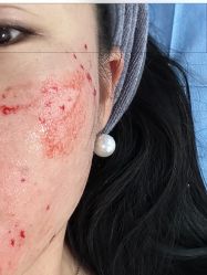 -新地崔劲松医疗美容