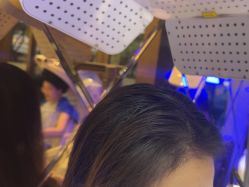 -碧莲盛·不剃发植发