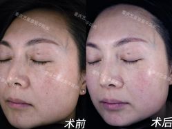 -Yestar重庆艺星医疗美容医院