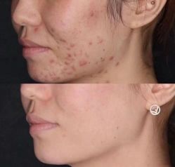 -痘院长·祛痘·皮肤管理