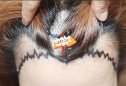 -大麦微针植发全国连锁