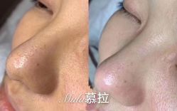 -慕拉美甲美睫皮肤管理