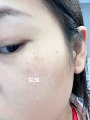 体验后-海峡医疗美容医院