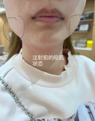 体验前-Yestar艺星医疗美容医院