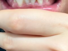 -微笑牙科口腔(三亚迎宾院区)