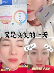 -Fundi张玉珊修身堂·indiba·BTL科技瘦身