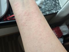 -北京东直门智选假日酒店