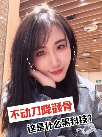 不动刀就能降低颧骨高度 这是什么新技术？