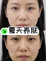 点击看大图 -云南吴氏嘉美医疗美容医院