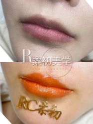 -RC半永久纹眉纹发际线