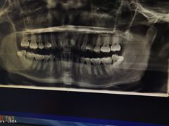 -上海市杨浦区牙病防治所