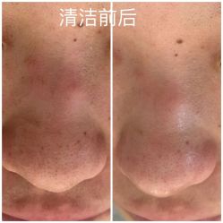 -skin79皮肤管理中心