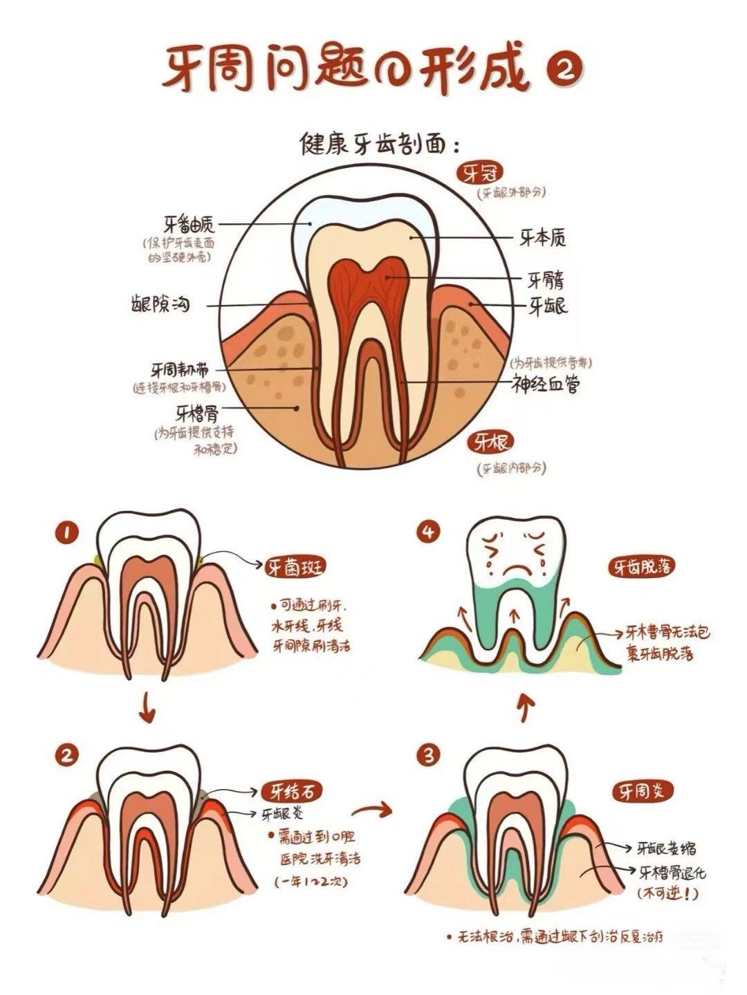 当大家🈶牙龈肿胀,刷牙出血🩸持续口臭