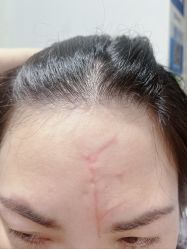 -痣斑堂·取大痣