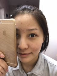 点击看大图 -西施无菌半永久纹绣眉眼影唇轻增发纹发际线