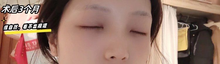 -素美医疗美容·西南眼鼻整形·修复基地