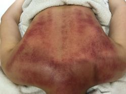 点击看大图 -苑苑vbeauty科技美容SPA