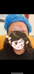 体验前-天津伊美尔医疗整形美容专科医院