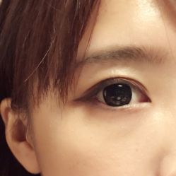 iphone_upload_pic-芷妍医美