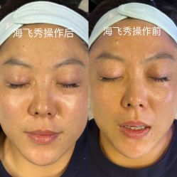-安吉拉青春化管理中心